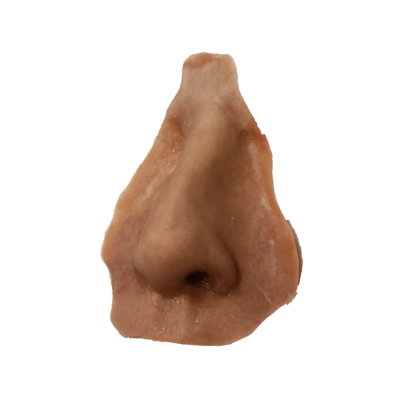 épithèse de nez