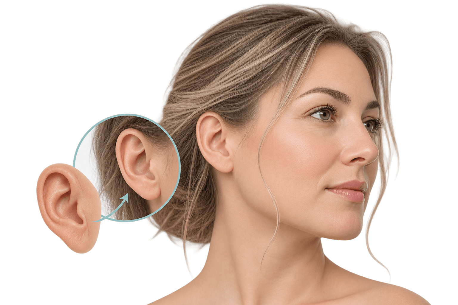 épithèse en silicone esthétique