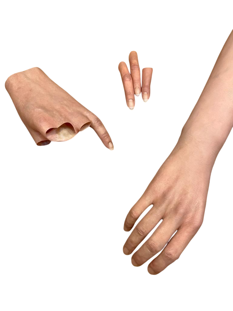 prothèses mixtes silicone esthétique